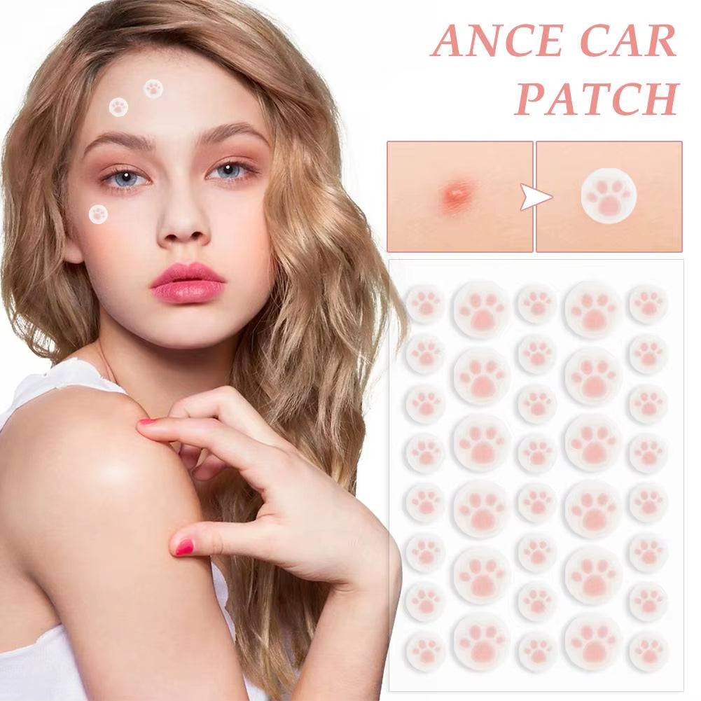 Hydrocolloid Acne Pimple Patch 36 Counts Cute Cat Paws Shaped Acne Absorbing Cover Patch, Invisible for Acne Dots