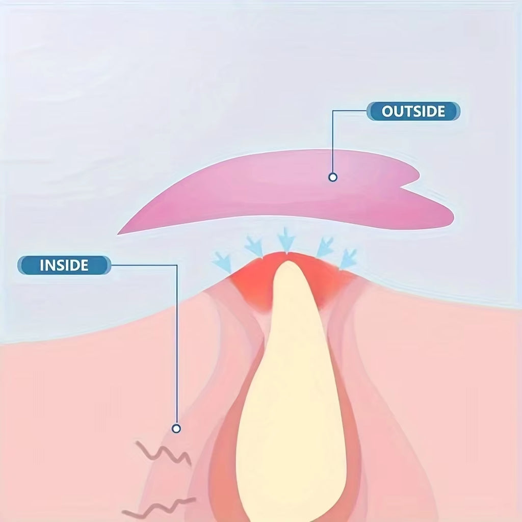 40/36 Pcs Pimple Patch Hydrocolloid Patches for Zits Cover, Spot Stickers for Face and Body.