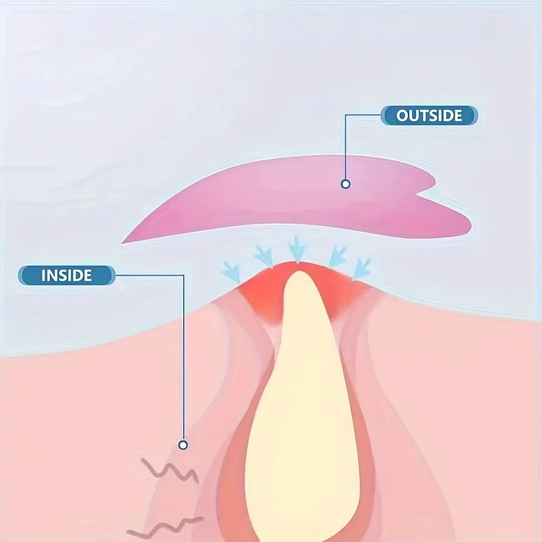 40/36 Pcs Pimple Patch Hydrocolloid Patches for Zits Cover, Spot Stickers for Face and Body.