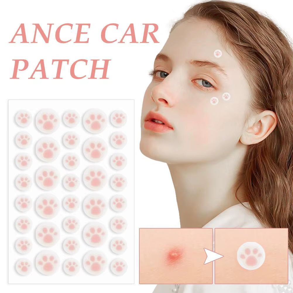 Hydrocolloid Acne Pimple Patch 36 Counts Cute Cat Paws Shaped Acne Absorbing Cover Patch, Invisible for Acne Dots